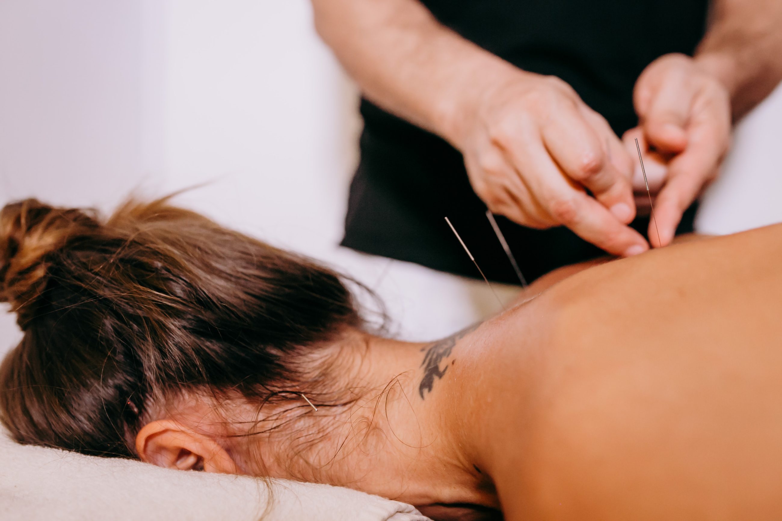 Médecine chinoise : les bienfaits de l’acupuncture pour booster la fertilité féminine et masculine.